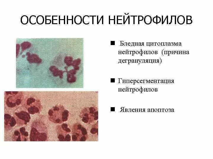 Адгезия нейтрофилов. Основная функция нейтрофилов. Полиморфноядерные гранулоциты. Палочкоядерный нейтрофил. Нейтрофилы под микроскопом.