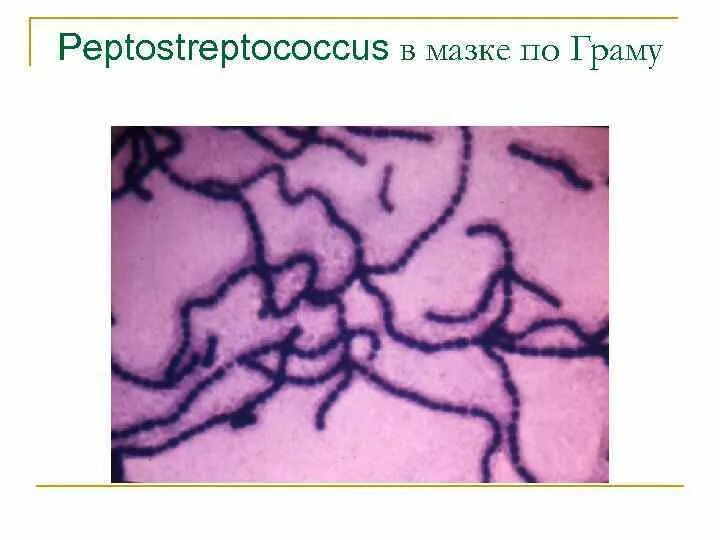 Peptostreptococcus spp