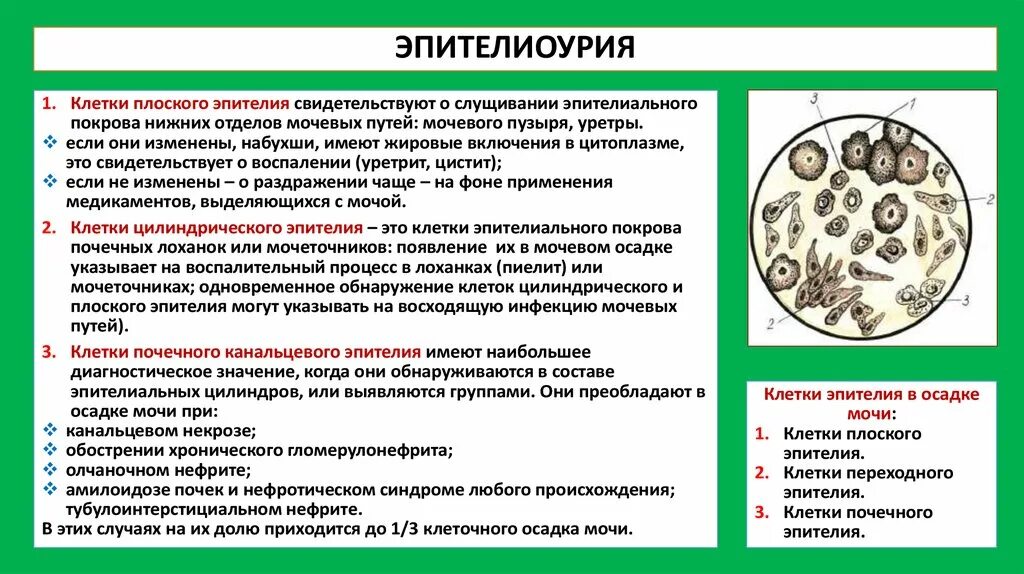 Повышенный эпителий плоский и лейкоциты. Клетки почечного эпителия в моче норма. эпителий в моче повышен у женщин причины. эпителий переходной в моче норма. клетки плоского эпителия в моче.