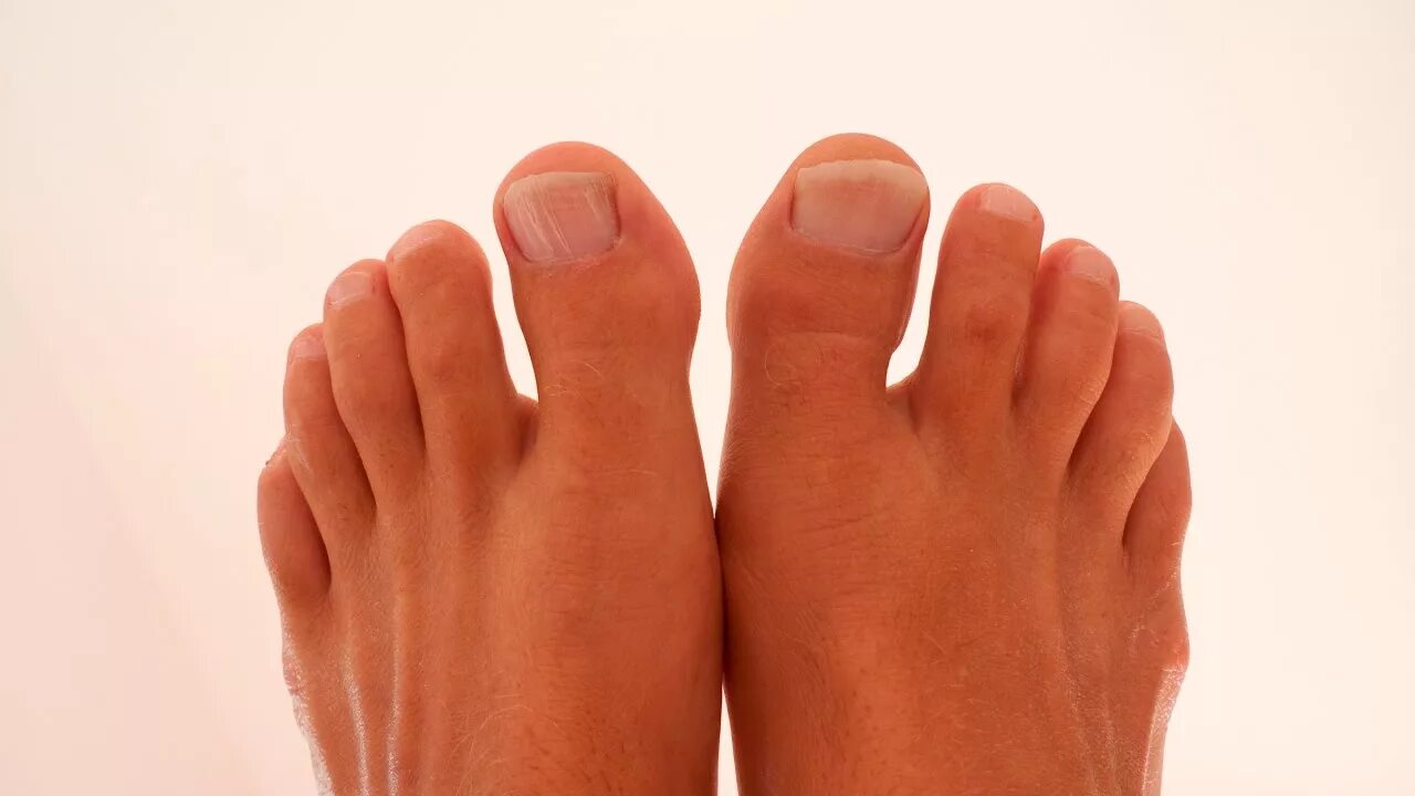 Здоровые пальцы ног. Много пальчиков