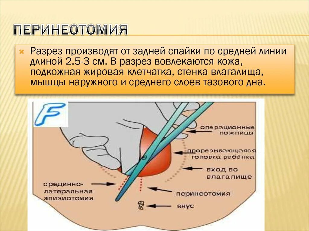 Разрыв половых органов