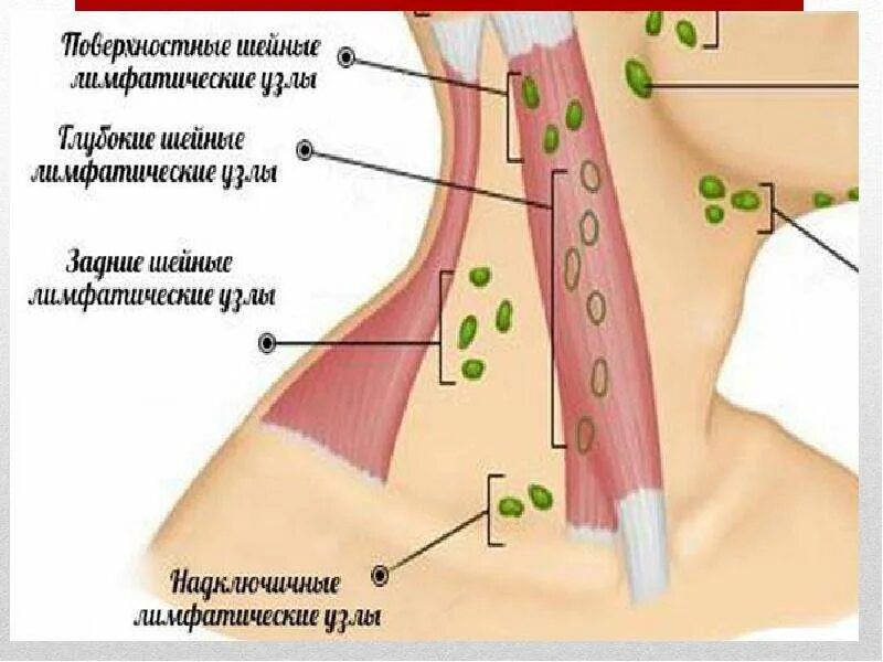 Болезненные лимфатические узлы. Надключичные лимфоузлы узлы. Шейные лимфоузлы анатомия. Сосцевидные лимфоузлы. Лимфоузлы на шее расположение.