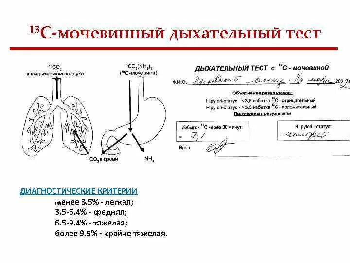 Нужен дыхательный тест. Мочевинный дыхательный тест. Дыхательный тест с мочевиной. Дыхательный тест с 13с-мочевиной. Дыхательный тест с мочевиной меченой с 13.