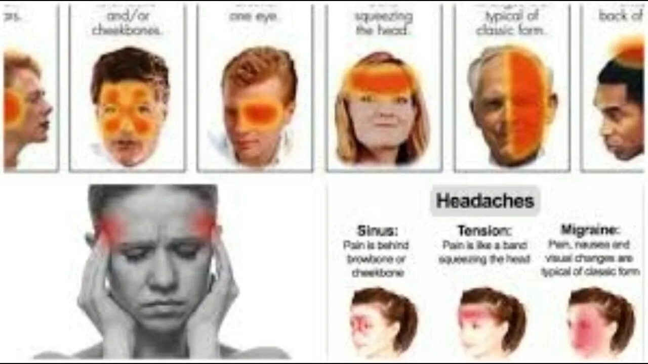 Головная боль Мем. Types of headache. Головная боль в синус.