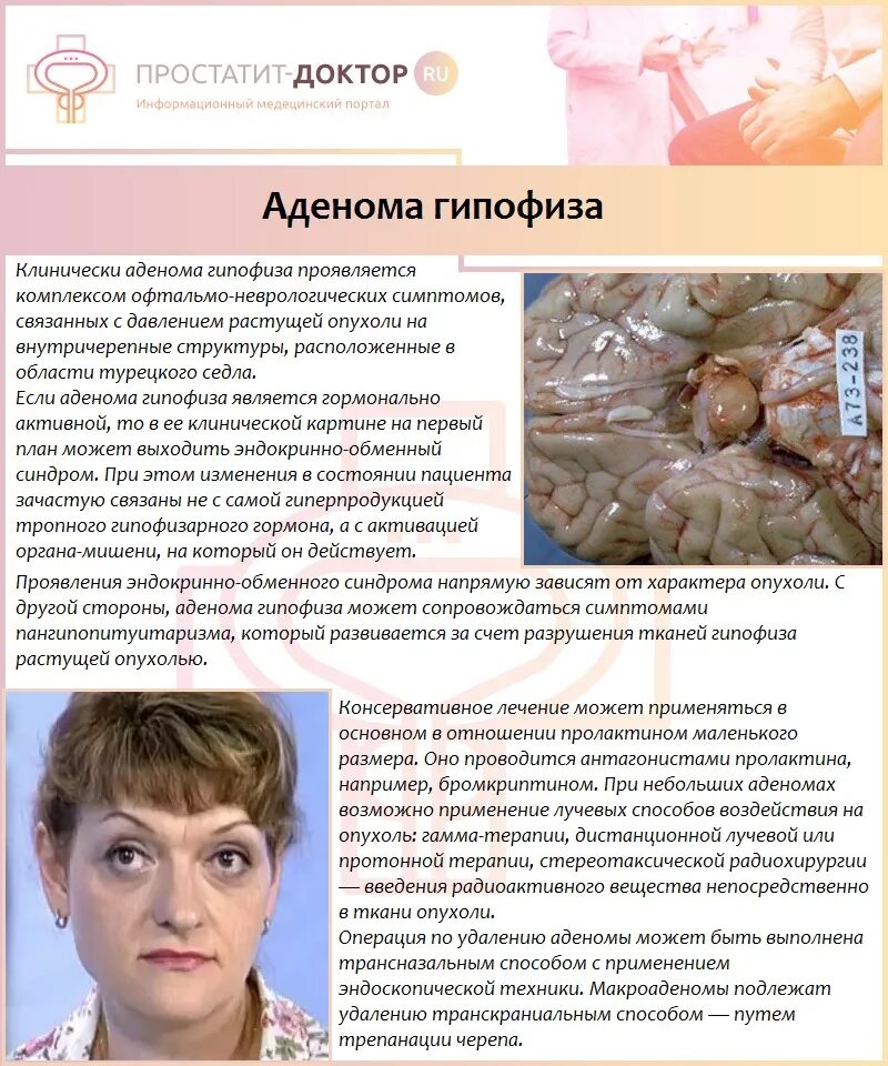 Гипофиза симптомы у женщин лечение прогноз. Симптомы аденом гепофеза. опухоль аденома гипофиза. аденома гипофиза симптомы.