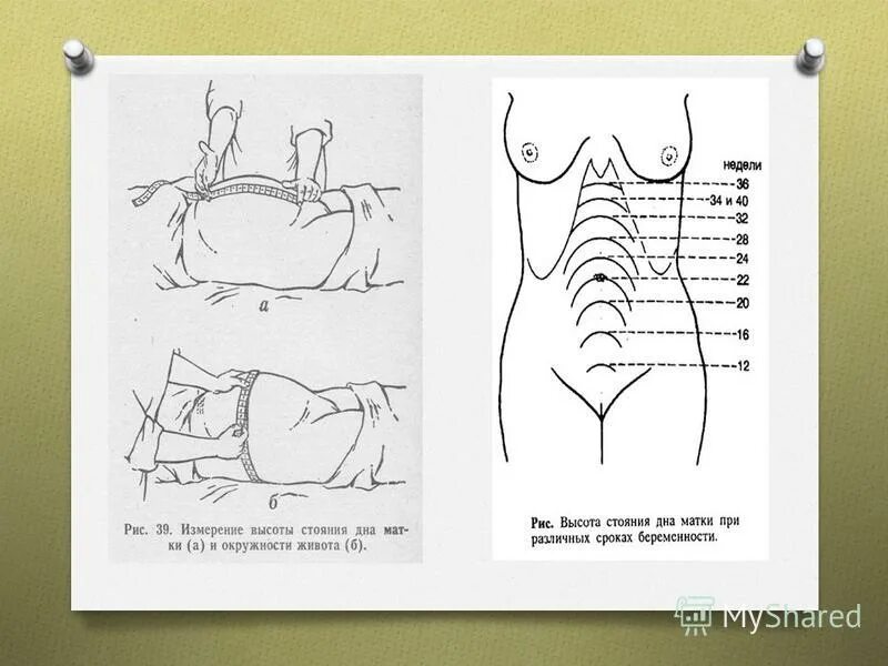 Измерение стояния дна матки беременной. Измерение высоты стояния дна матки у беременной. Измерение окружности и высоты стояния дна матки. Измерение ож и ВДМ. Матка на 35 неделе беременности