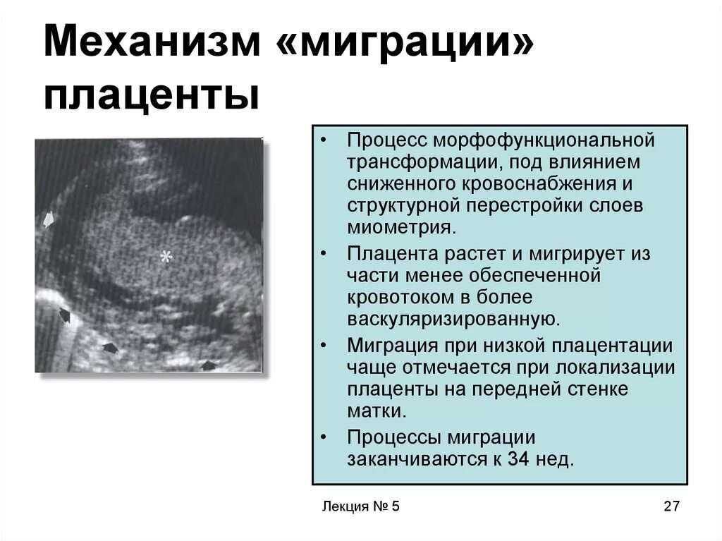 Плацента на рубце матки. Миграция плаценты симптомы. Механизм миграции плаценты. УЗИ низкого положения плаценты. Начало формирования плаценты.