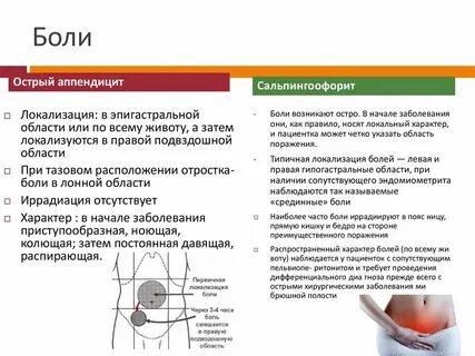 Острая боль в животе при аппендиците