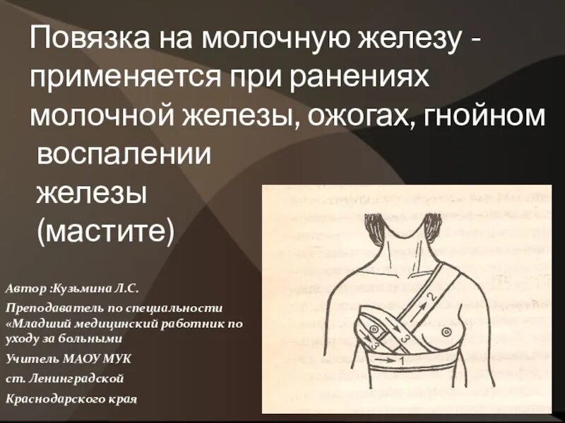 Повязка на молочные железы алгоритм. Наложите бинтовую повязку на молочную железу.. Наложение повязки на молочную железу алгоритм. Повязка на ммолочнаю эеоуз. Повзяеп на иолосную железу.