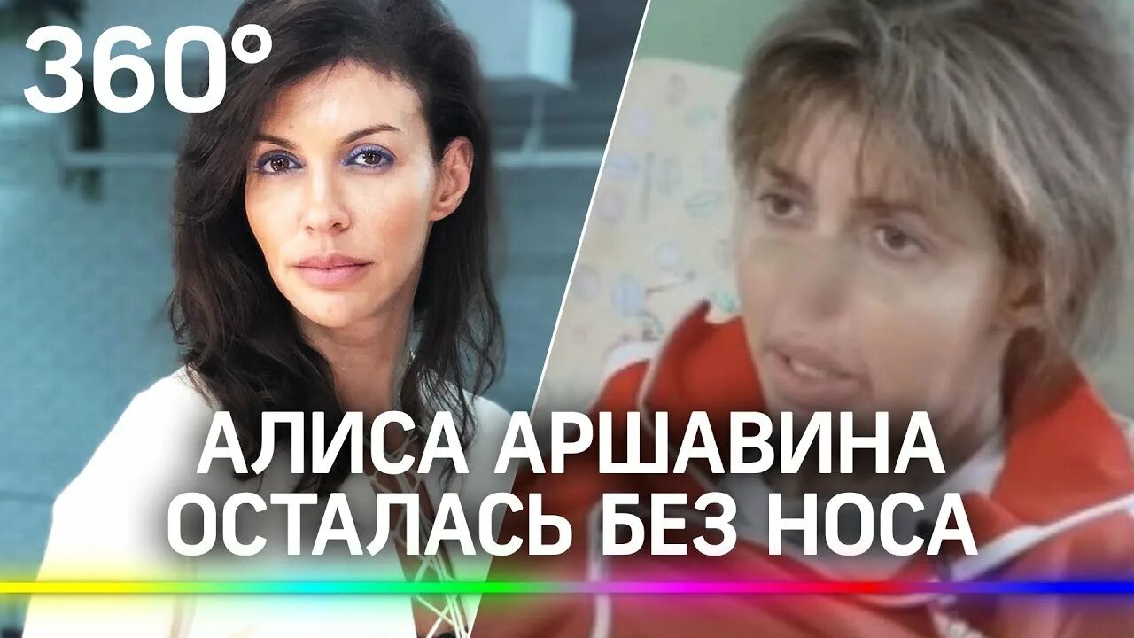 Почему аршавина без носа. Алиса Аршавина без носа. Бывшая Аршавина осталась без носа. Алиса Казьмина осталась без носа.