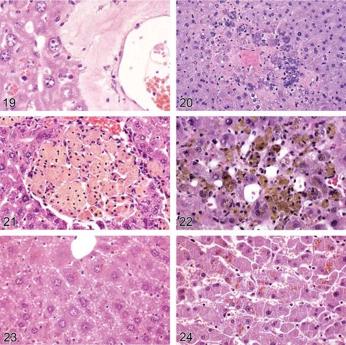 Клетки печени крыс. Транстиретиновый амилоидоз. Печень крысы гистология. Макрофаги печени крысы препарат гистология.