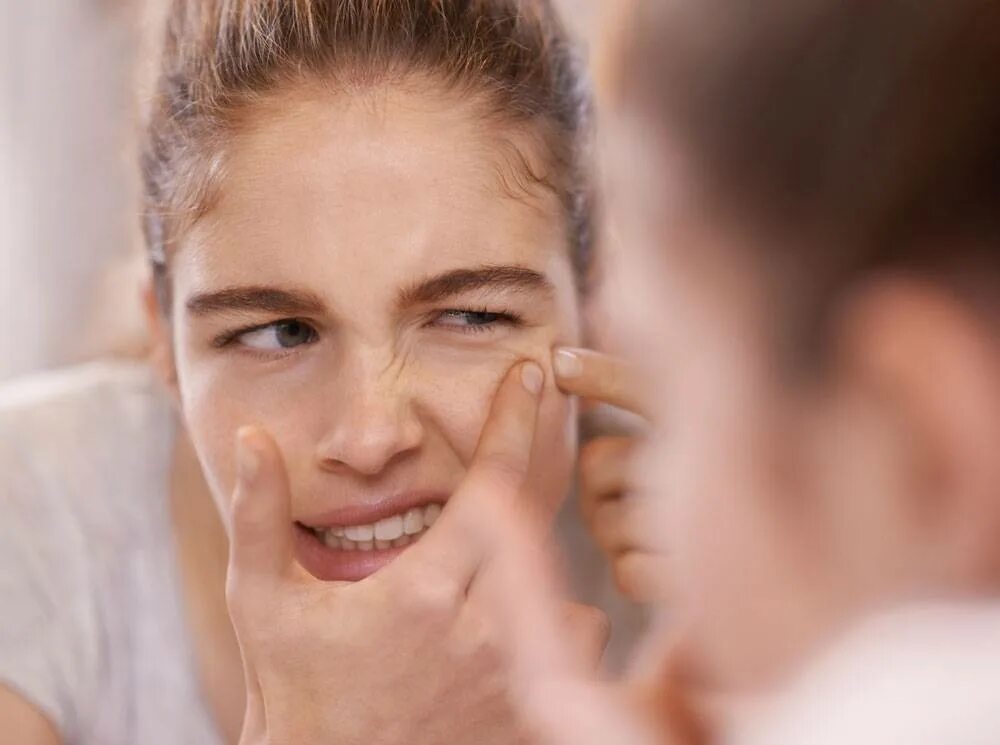 Кожа в подростковом возрасте. Кожа в подростковом возрасте. Кожа в подростковом возрасте. Здоровая кожа подростка. Кожа в подростковом возрасте.