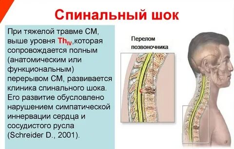 Спинальный шок механизм
