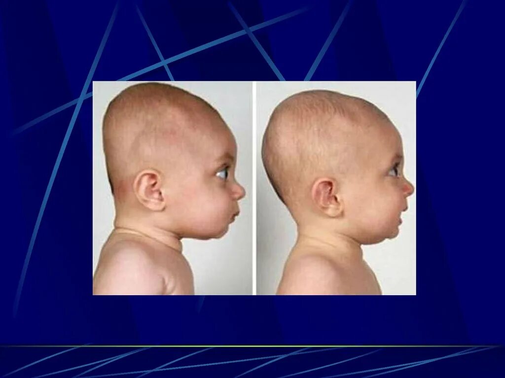 Череп человека состоит из лицевого и мозгового отделов. Преобладание мозгового черепа над лицевым. Преобладание мозгового черепа над лицевым. Преобладание мозгового черепа над лицевым. Сравнение черепа человека и обезьяны.