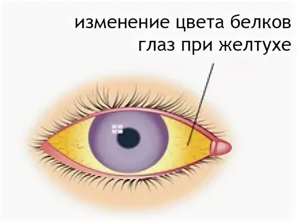 Умные белки. О чем говорят белки глаза. Проекция органов на радужке глаза. Белок глаза с красными прожилками. Белая полоска между радужкой и нижним веком.