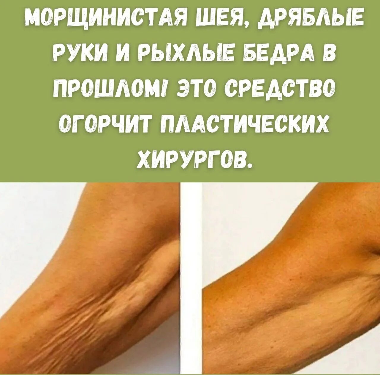 Старые дряблые женщины. Значение слова ябеда. Слово дня инстаграм. Ябеда. Слово дня.