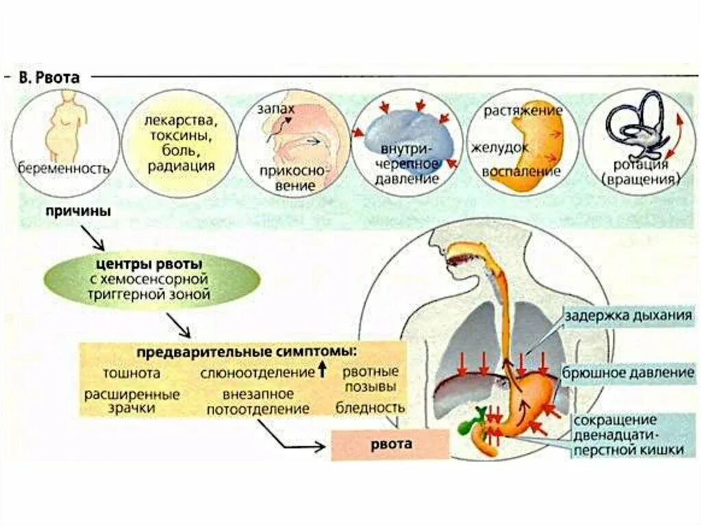 Почему много тошнит. Схема рвотного рефлекса. Причины рвотного рефлекса. Появился рвотный рефлекс. Рефлекторная рвота.