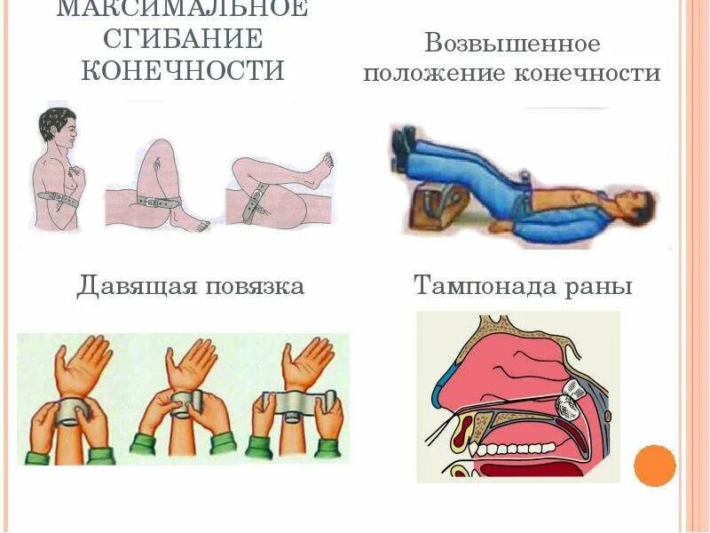 Придать конечности положение. Возвышенное положение конечности при кровотечении. возвышенное положение при кровотечении. придать конечности возвышенное положение.