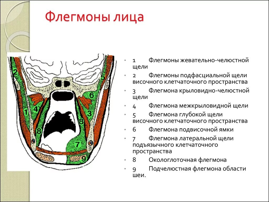 Пространства полости рта. Латеральное клетчаточное пространство дна полости рта. Крыловидно челюстное клетчаточное пространство. Жевательно челюстное клетчаточное пространство. Крыловидно нижнечелюстное клетчаточное пространство.