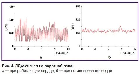 Флоуметрия