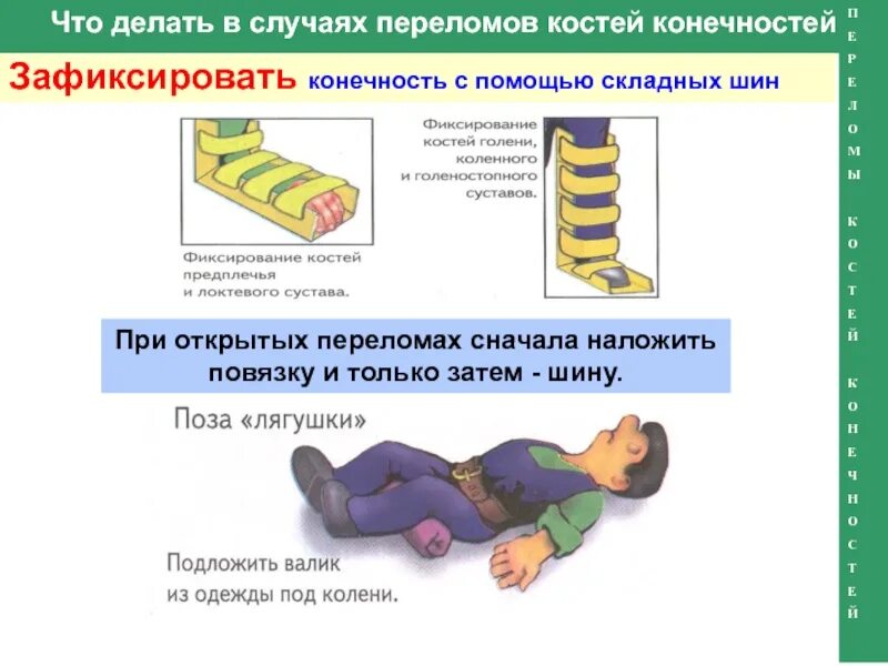 1 первая помощь при открытом переломе. При открытых переломах конечностей. при открытых переломах конечностей необходимо:. первая помощь при переломах. оказание первой помощи при переломах конечностей.