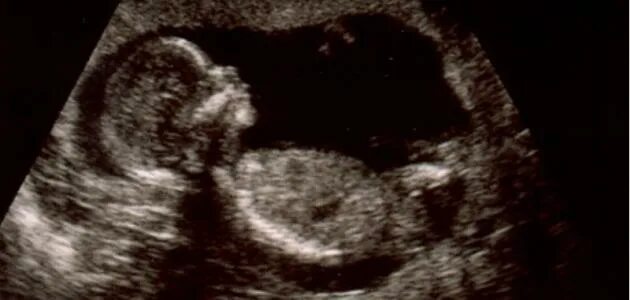 Как на уз выглядит ребенок small baby for dates shocked 2021 baby news Baby ultrasound, Baby ultrasound p