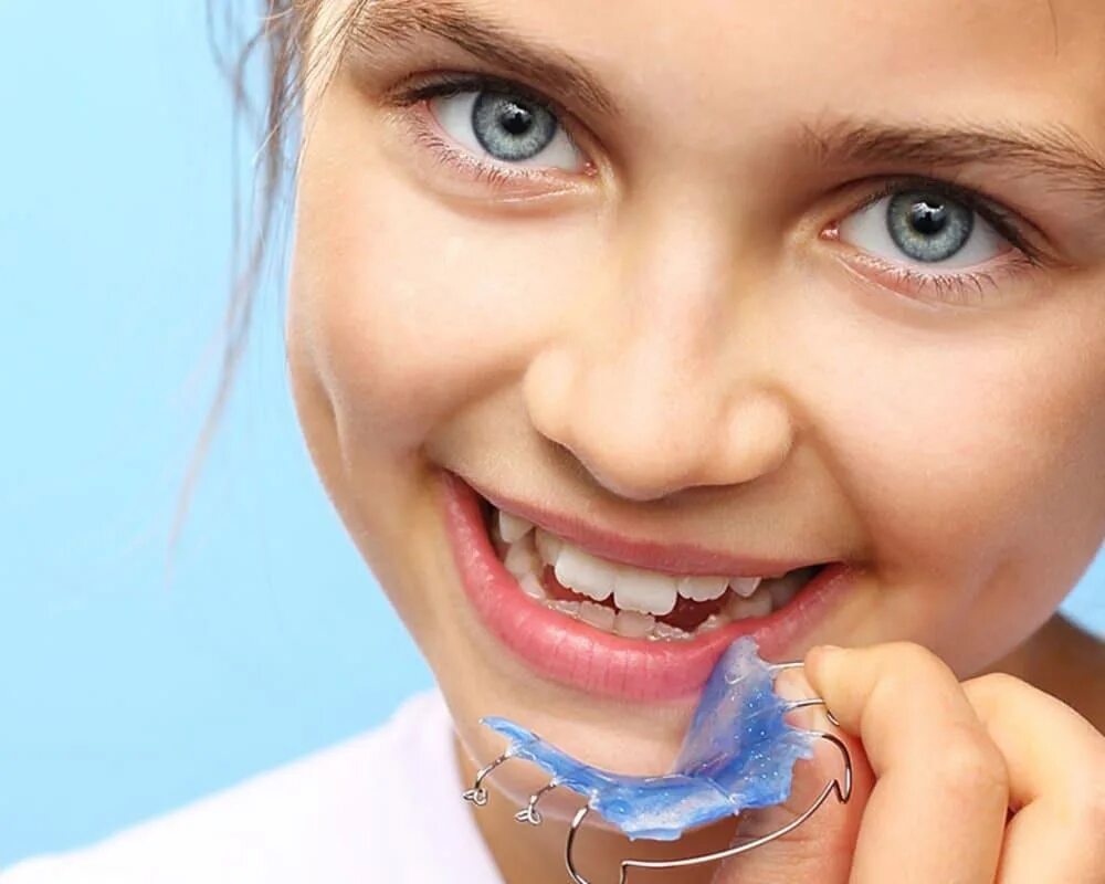 Ортодонтия для детей. Пластина для зубов для исправления прикуса. Зубные брекеты для детей.