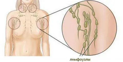 Лимфоузлы 11 мм