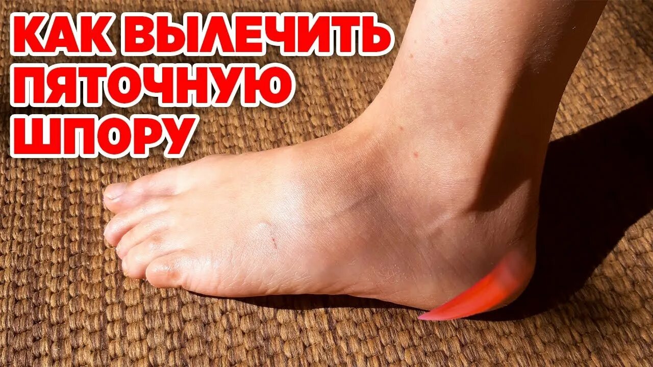 Как быстро снять боль в пятке Как вылечить боль в стопе и пятке YouTube