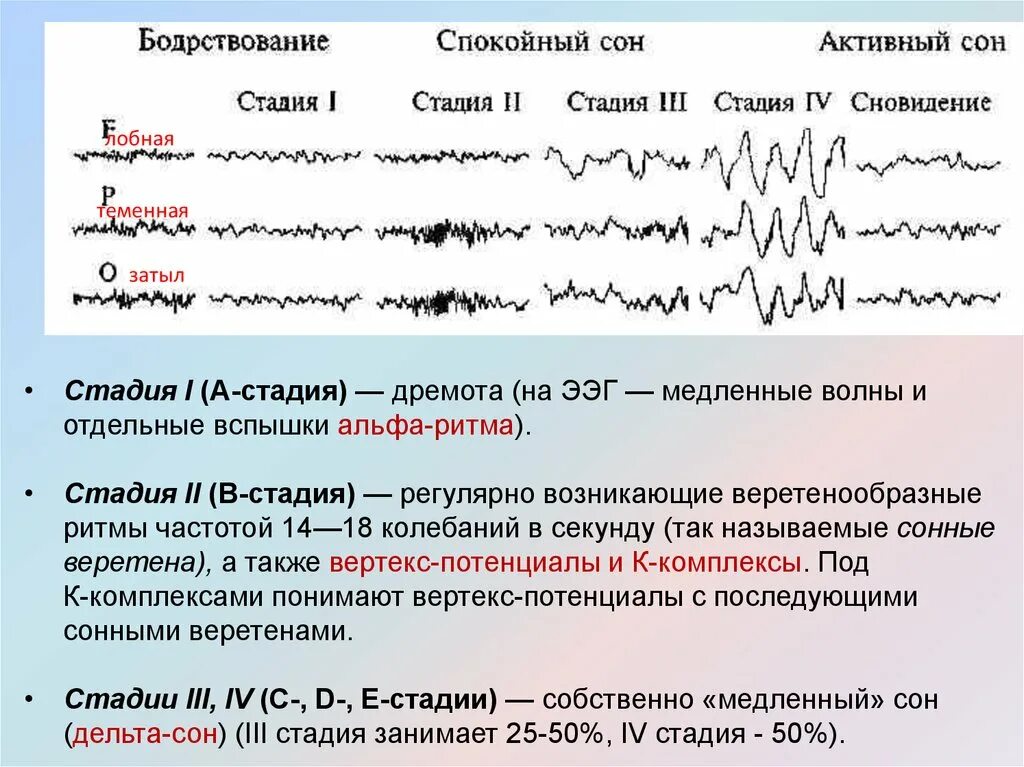 Ээг бодрствования. Стадии сна на ЭЭГ. Медленный сон ритм ЭЭГ. Веретена сна на ЭЭГ.