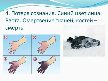 4 потерял сознание