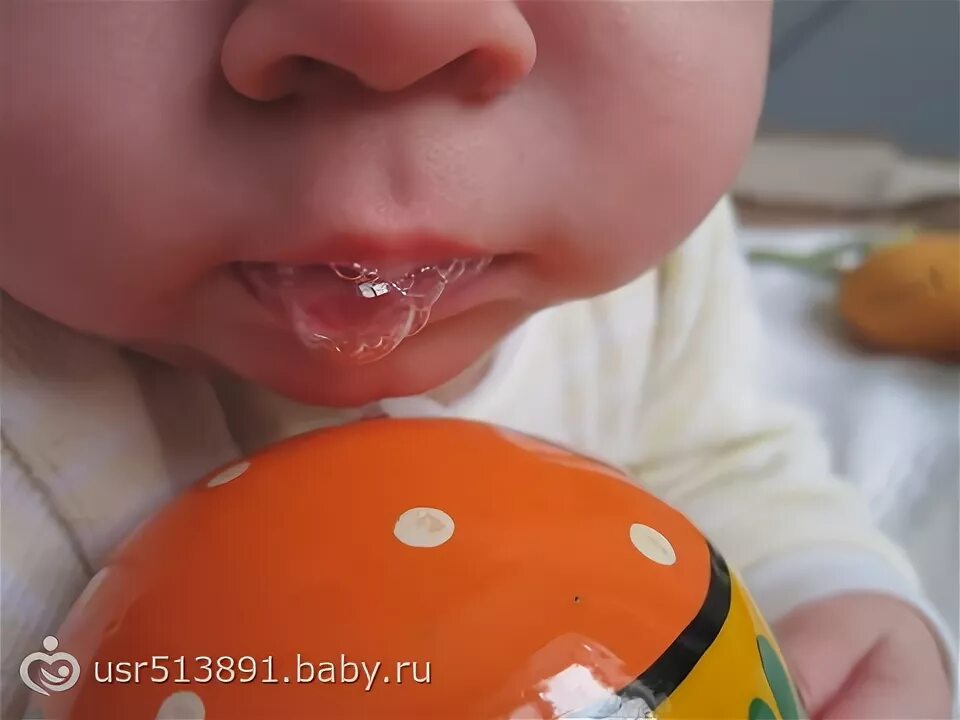 Пена ртом пошла