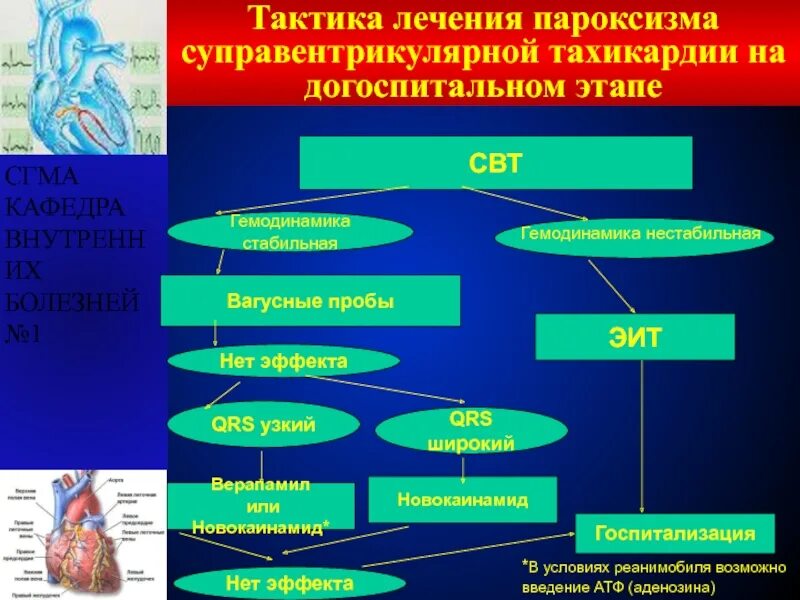 Нестабильная гемодинамика. Пароксизмальная суправентрикулярная тахикардия тактика лечения. Стабильная и нестабильная гемодинамика. Тактика ведения пациента при пароксизмальной тахикардии. Гемодинамика.