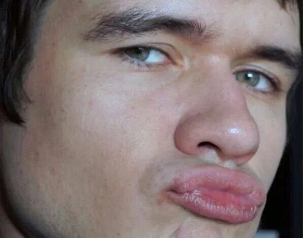 Сводит губы что это. Сводит губы что это