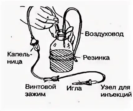 Заполнение внутривенной системы алгоритм. Система для внутривенного капельного вливания. Устройство системы для внутривенного капельного вливания схема. Устройство системы для внутривенного капельного вливания рисунок. Устройство капельной системы для внутривенного введения.