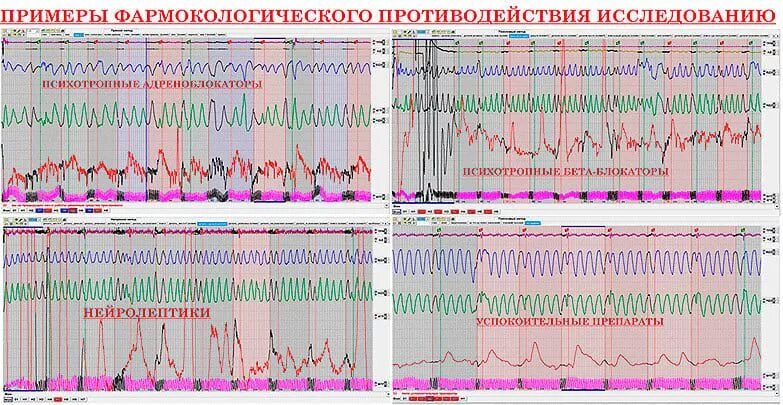 Полиграф пример. Как выглядит ложь на полиграфе. показатели полиграфа. полиграф шкала лжи. показатели прохождения полиграфа.