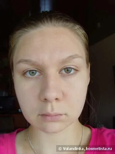 Один глаз выпирает больше другого. Асимметричные брови. Веко одного глаза ниже другого. Асимметрия глаз. Асимметрия глазных щелей.