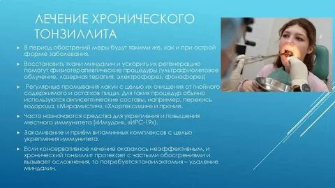 Лекарство от воспаления гланд