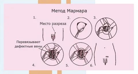 Восстановление после мармара