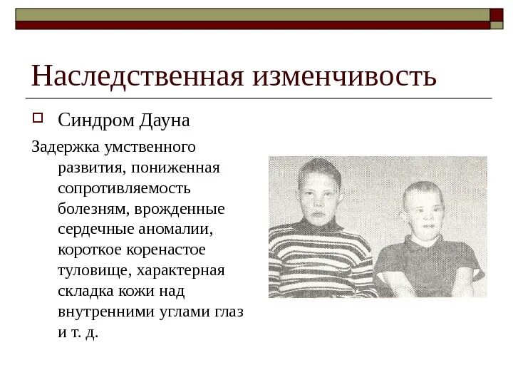 Синдром дауна наследственное заболевание или нет. Рождение ребенка с синдромом дауна форма изменчивости. синдром дауна наследственность. синдром дауна какая изменчивость. закономерности изменчивости.