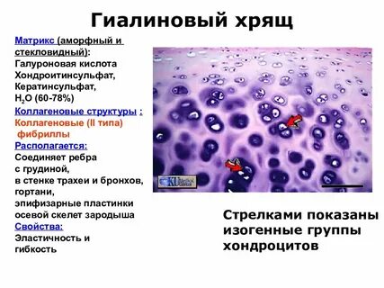 Межклеточного вещества в виде минерализованных пластинок