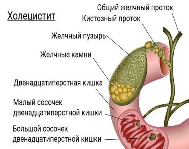 Слизистая оболочка желчного пузыря. Строение желчного пузыря слои. Строение стенки желчного пузыря анатомия. Внутреннее строение желчного пузыря. Холецистит анатомия желчного пузыря.