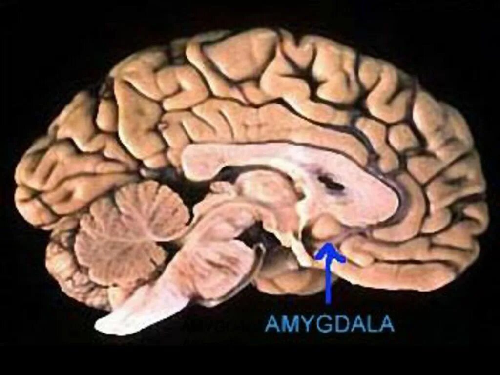 Миндалевидное тело. Миндалевидное тело в головном мозге функции. Амигдала и эмоции. Амигдала латеральная мозг лошади.