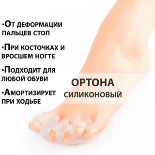 Стельки мортона