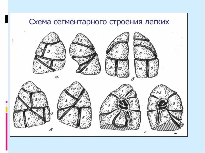 Доли и сегменты легкого. 4 сегмент легкого. топографическая анатомия легких доли сегменты. сегменты нижней доли правого легкого схема. лондонская классификация сегментов легких.