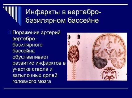 Вбб