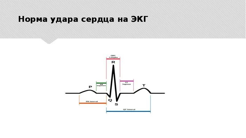 Экг норма пульса. Экг норма пульса. Электрокардиограмма показатели синусовый ритм. Высокий пульс на экг. Как посчитать чсс на экг по клеточкам.