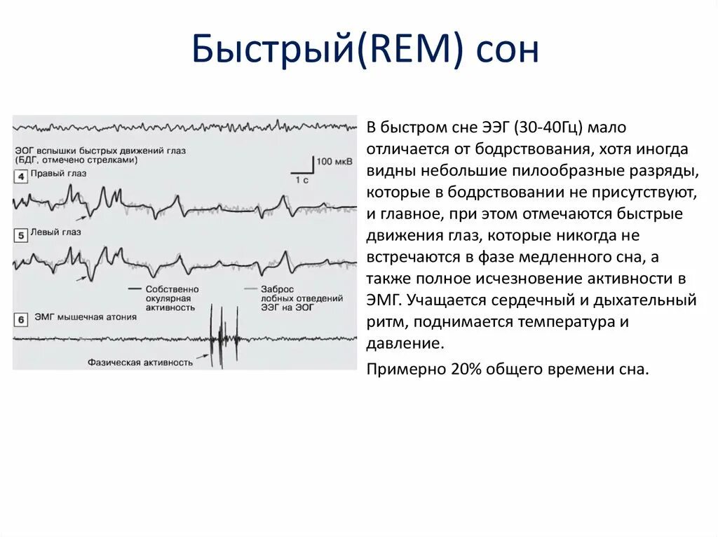 Ээг бодрствования. Rem фаза сна ЭЭГ. ЭЭГ-корреляты фаз сна.. Веретена на ЭЭГ. Ритм ЭЭГ В фазу быстрого сна.