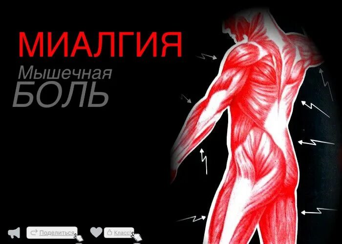 Как лечить миалгию мышц. Боль в мышцах.