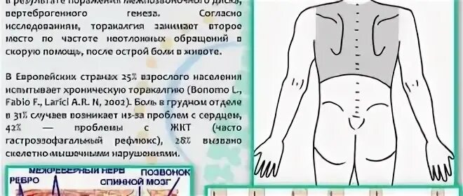 Торакалгия что это за диагноз